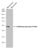 Anti-CaMKII alpha (phospho Thr286) antibody used in Western Blot (WB). GTX133859