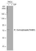 Anti-Ezrin (phospho Thr567) antibody used in Western Blot (WB). GTX133868