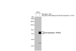 Anti-Ezrin (phospho Thr567) antibody used in Western Blot (WB). GTX133868