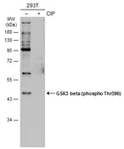 Anti-GSK3 beta (phospho Thr390) antibody used in Western Blot (WB). GTX133870