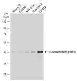 Anti-c-Jun (phospho Ser73) antibody used in Western Blot (WB). GTX133873
