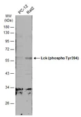Anti-Lck (phospho Tyr394) antibody used in Western Blot (WB). GTX133876