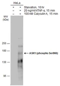 Anti-ASK1 (phospho Ser966) antibody used in Western Blot (WB). GTX133878