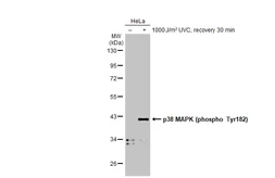 Anti-p38 MAPK (phospho Tyr182) antibody used in Western Blot (WB). GTX133881