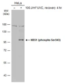 Anti-NBS1 (phospho Ser343) antibody used in Western Blot (WB). GTX133883
