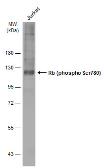Anti-Rb (phospho Ser780) antibody used in Western Blot (WB). GTX133893