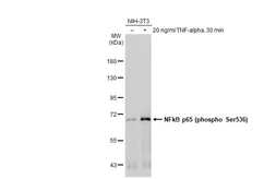 Anti-NFkB p65 (phospho Ser536) antibody used in Western Blot (WB). GTX133899