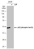 Anti-p53 (phospho Ser33) antibody used in Western Blot (WB). GTX133902