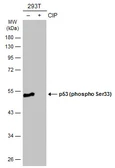 Anti-p53 (phospho Ser33) antibody used in Western Blot (WB). GTX133902