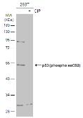 Anti-p53 (phospho ser392) antibody used in Western Blot (WB). GTX133904