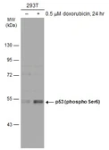 Anti-p53 (phospho Ser6) antibody used in Western Blot (WB). GTX133905