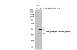 Anti-JNK (phospho Thr183/Tyr185) antibody used in Western Blot (WB). GTX133934