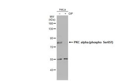 Anti-PKC alpha (phospho Ser657) antibody used in Western Blot (WB). GTX133936