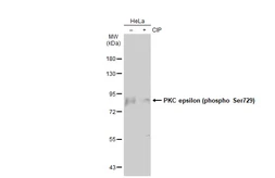 Anti-PKC epsilon (phospho Ser729) antibody used in Western Blot (WB). GTX133937