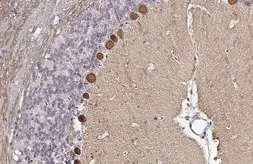 Anti-PKC zeta (phospho Thr410) antibody used in IHC (Paraffin sections) (IHC-P). GTX133939