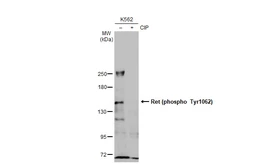 Anti-Ret (phospho Tyr1062) antibody used in Western Blot (WB). GTX133941