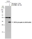 Anti-RPS6 (phospho Ser240/Ser244) antibody used in Western Blot (WB). GTX133942