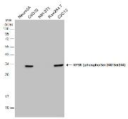 Anti-RPS6 (phospho Ser240/Ser244) antibody used in Western Blot (WB). GTX133942