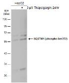 Anti-SQSTM1 / P62 (phospho Ser272) antibody used in Western Blot (WB). GTX133943