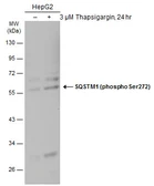 Anti-SQSTM1 / P62 (phospho Ser272) antibody used in Western Blot (WB). GTX133943
