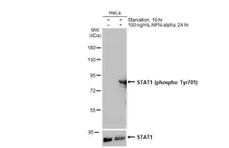 Anti-STAT1 (phospho Tyr701) antibody used in Western Blot (WB). GTX133944