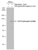 Anti-STAT2 (phospho Tyr690) antibody used in Western Blot (WB). GTX133945