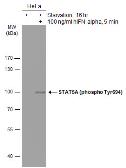Anti-STAT5A (phospho Tyr694) antibody used in Western Blot (WB). GTX133947