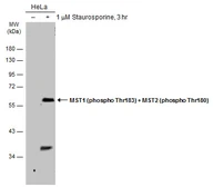 Anti-MST1 (phospho Thr183) + MST2 (phospho Thr180) antibody used in Western Blot (WB). GTX133948