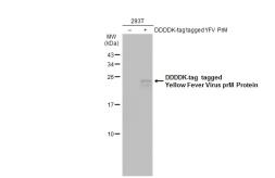 Anti-Yellow Fever virus prM Protein antibody used in Western Blot (WB). GTX133957