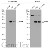 Anti-BOB1 antibody used in Western Blot (WB). GTX133968