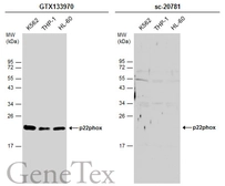 Anti-p22phox antibody used in Western Blot (WB). GTX133970