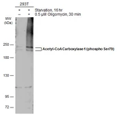 Anti-Acetyl-CoA Carboxylase 1 (phospho Ser79) antibody used in Western Blot (WB). GTX133974
