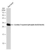Anti-Cardiac Troponin I (phospho Ser23/Ser24) antibody used in Western Blot (WB). GTX133976