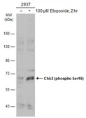 Anti-Chk2 (phospho Ser19) antibody used in Western Blot (WB). GTX133989