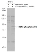 Anti-MDM2 (phospho Ser166) antibody used in Western Blot (WB). GTX133996