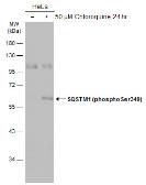 Anti-SQSTM1 / P62 (phospho Ser349) antibody used in Western Blot (WB). GTX134001