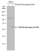 Anti-SQSTM1 / P62 (phospho Ser349) antibody used in Western Blot (WB). GTX134001