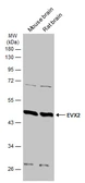 Anti-EVX2 antibody used in Western Blot (WB). GTX134003