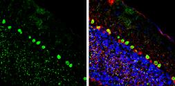 Anti-CGRP antibody used in IHC (Frozen sections) (IHC-Fr). GTX134005