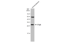 Anti-C1qA antibody used in Western Blot (WB). GTX134007