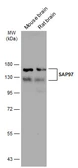 Anti-SAP97 antibody used in Western Blot (WB). GTX134011