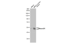 Anti-NeuroD1 antibody used in Western Blot (WB). GTX134069