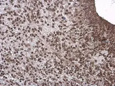 Anti-Neurogenin 1 antibody used in IHC (Paraffin sections) (IHC-P). GTX134080
