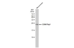 Anti-CD90 antibody used in Western Blot (WB). GTX134082