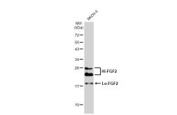 Anti-FGF2 antibody used in Western Blot (WB). GTX134090
