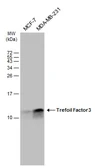 Anti-Trefoil Factor 3 antibody used in Western Blot (WB). GTX134098