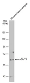 Anti-vGluT3 antibody used in Western Blot (WB). GTX134103