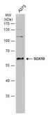 Anti-SOX10 antibody used in Western Blot (WB). GTX134106