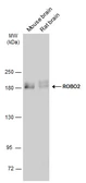 Anti-ROBO2 antibody used in Western Blot (WB). GTX134119