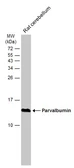 Anti-Parvalbumin antibody used in Western Blot (WB). GTX134127